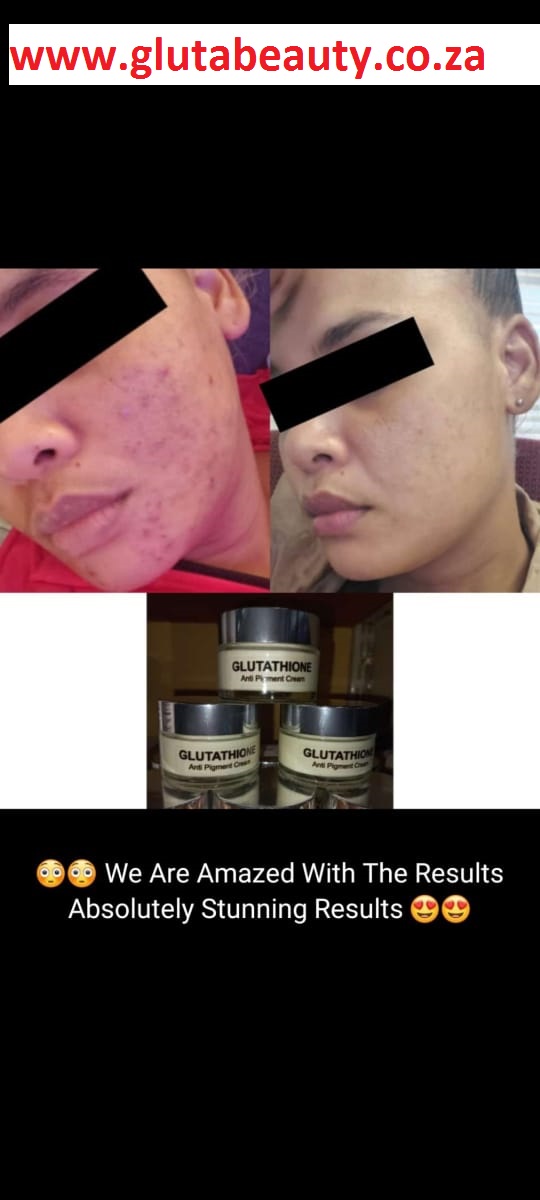 Gluta Beauty 70g - best cream for pigmentation - Image 12